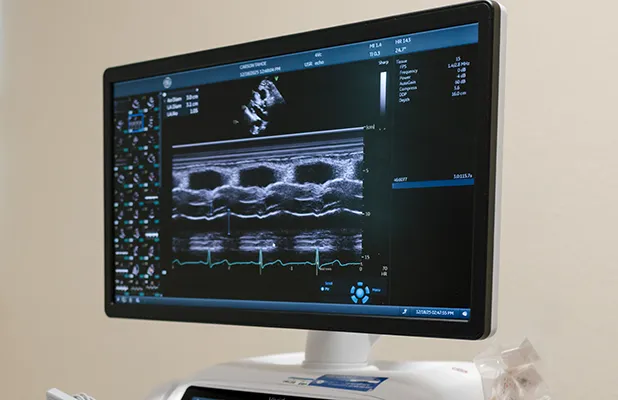 Cardiac Outpatient Procedures